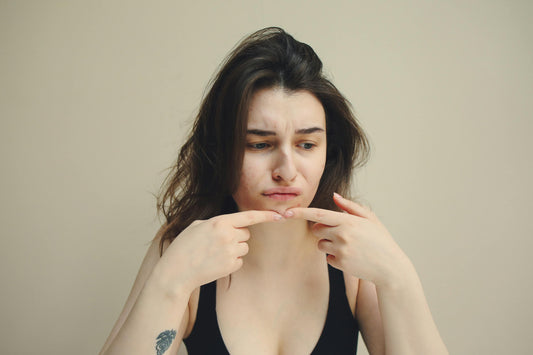 How to Care for Breakouts with Wonder Serum